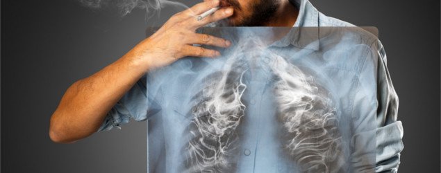 男人吸烟与x射线肺部